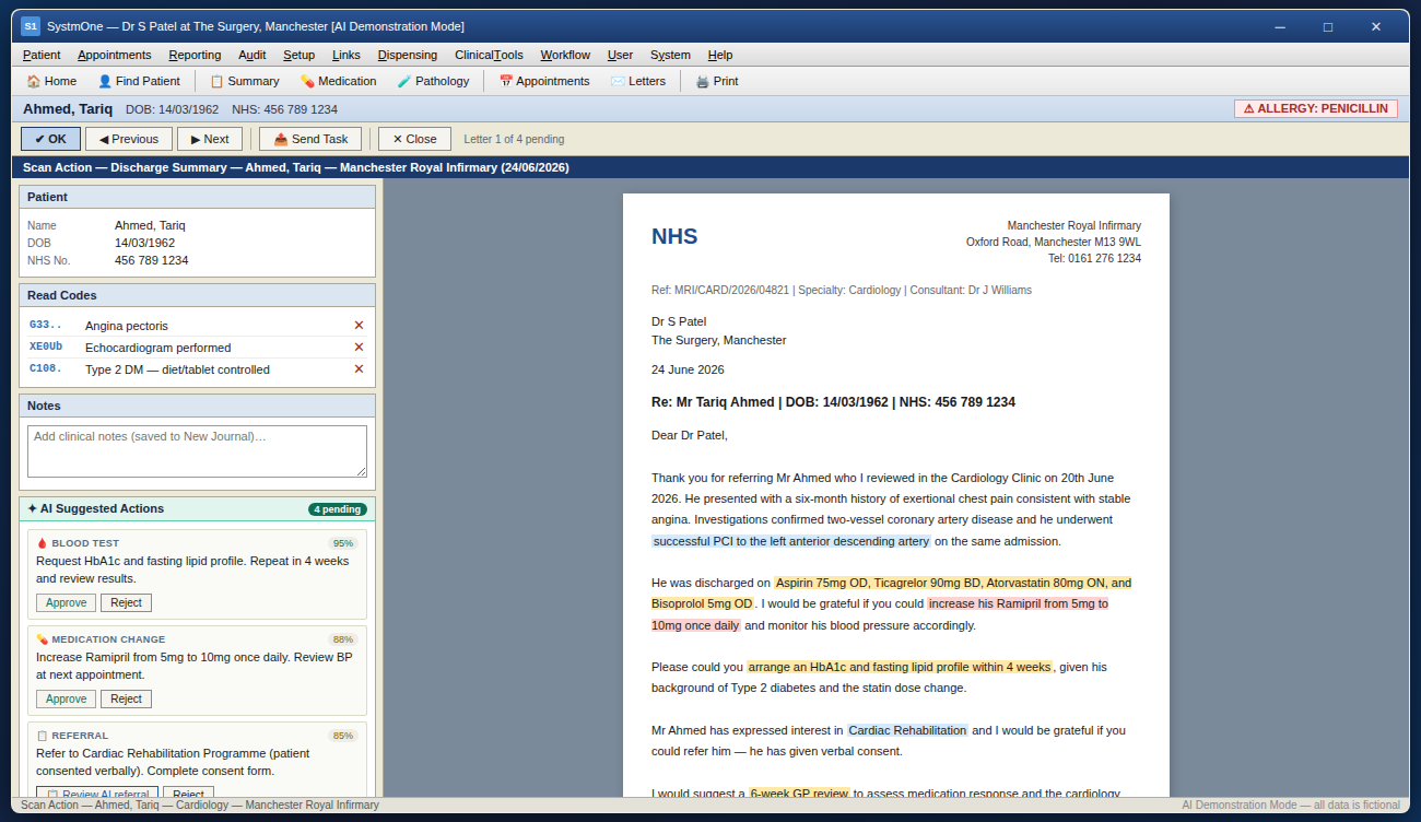 Care Continuo AI integrated into the SystmOne Scan Action screen, showing AI-extracted tasks from a cardiology discharge letter